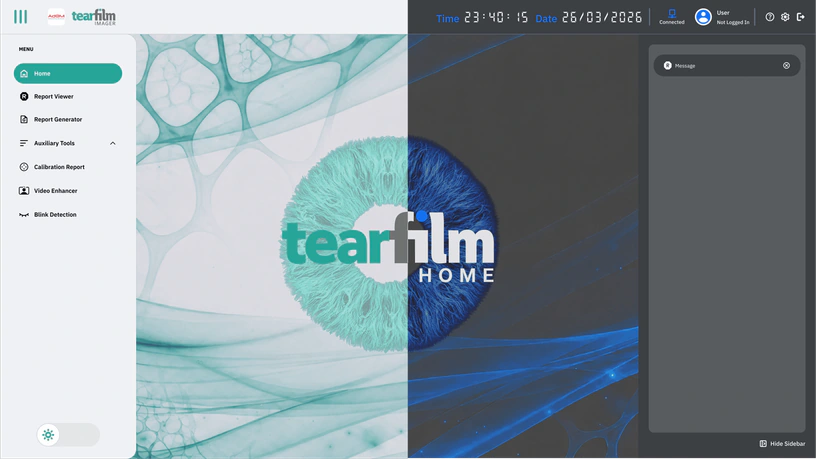 TFI Workplace tear film analysis workspace
