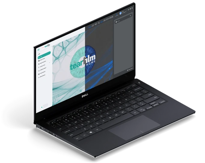 Laptop showing the TFI Workspace tear film analysis interface in light and dark modes