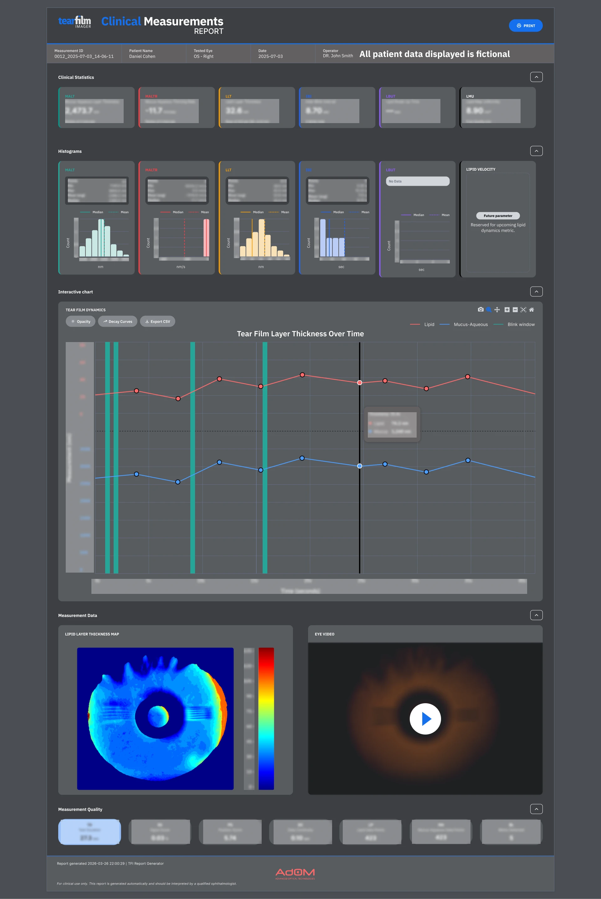 Redesigned clinical measurements report in dark mode with examination graphs and eye layer analysis
